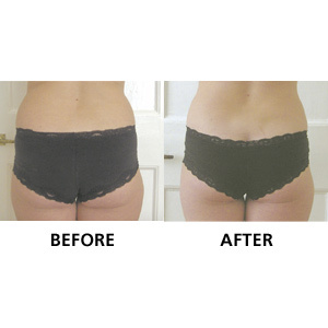Reduce saddlebags