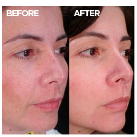 Skin discolouration