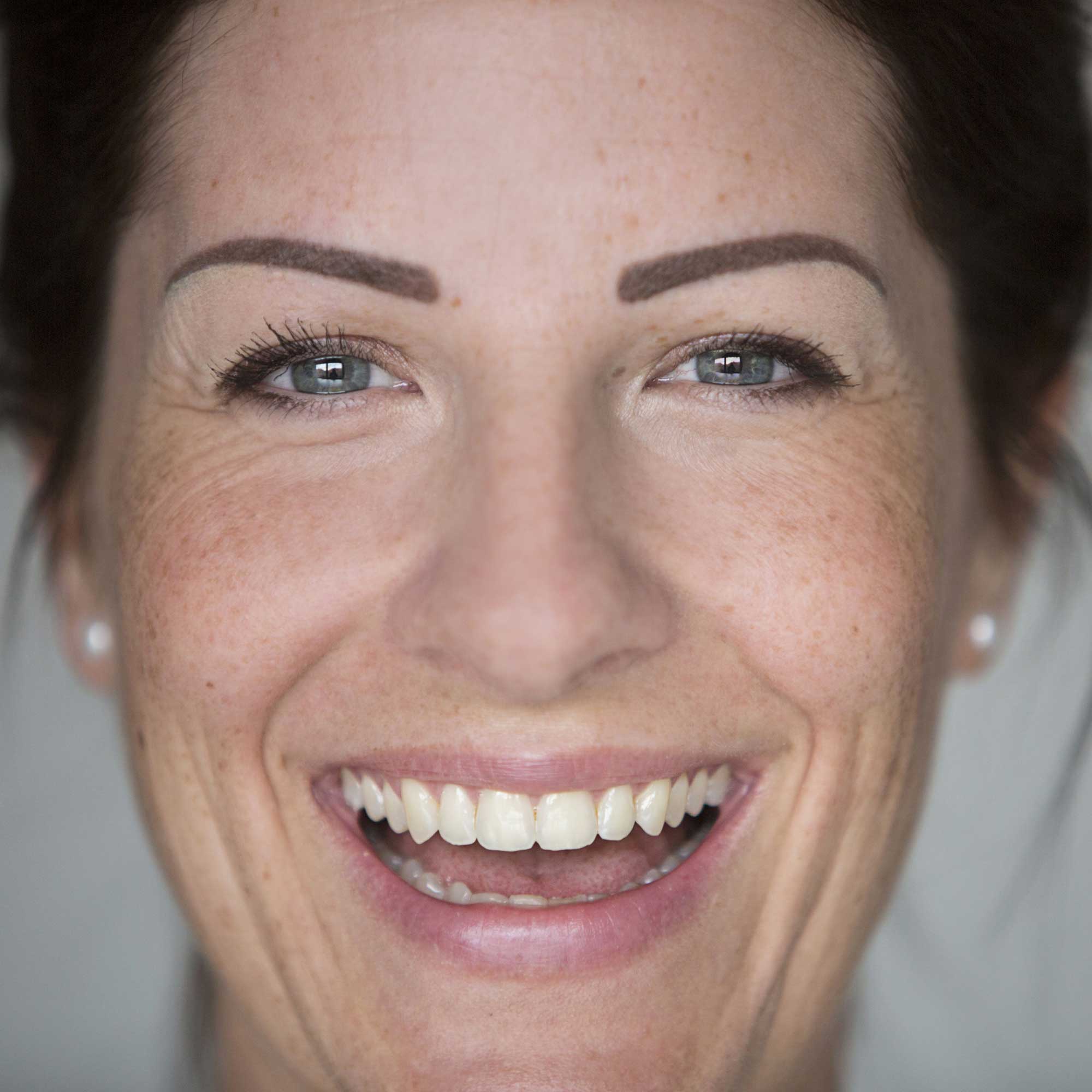 Top 10 Dark Spot Correctors Top 10 Dark Spot Correctors